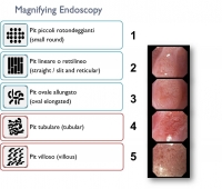 Esofago Pisa